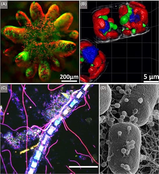 4 Examples of Microbial Imaging Techniques